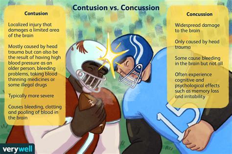 Contusion vs. Concussion: How They Compare.